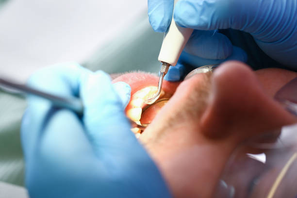 Best Dentist for Tooth Abscess  in Logan, UT